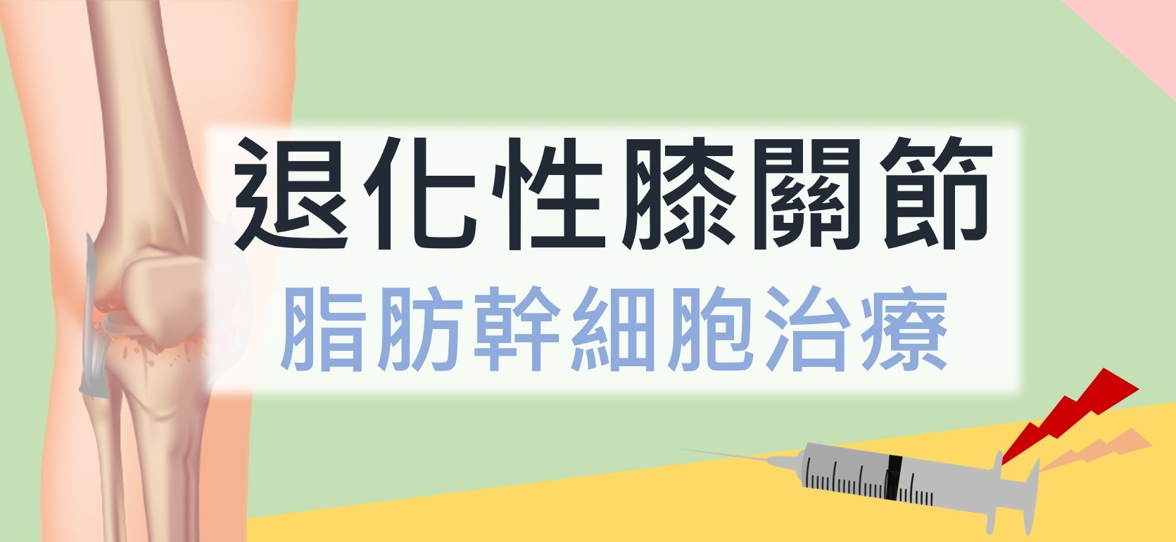 間質幹細胞治療退化性關節炎QA